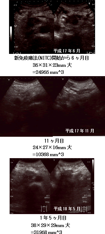 【症例報告】 膵臓癌　超音波検査画像の推移