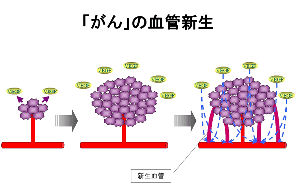 新免疫療法の新生血管抑制作用